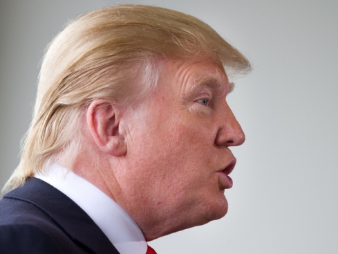 donald trump hair piece. Now We Know: Donald Trump#39;s